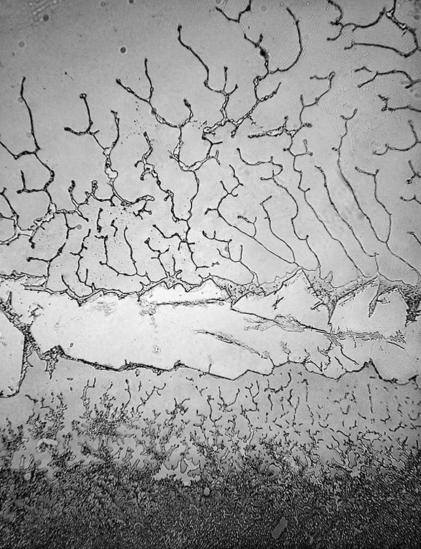 Basal-tears-6